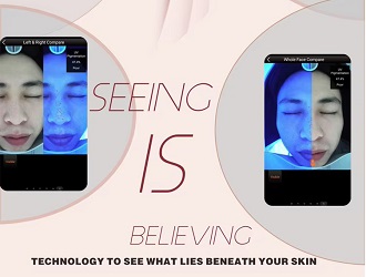  AI-Powered Aging Prediction & Smart Product Recommendation ：It clinically measures skin conditions and predicts future trends (3-5 years), directly recommending products to boost instant treatment bookings and product sales.